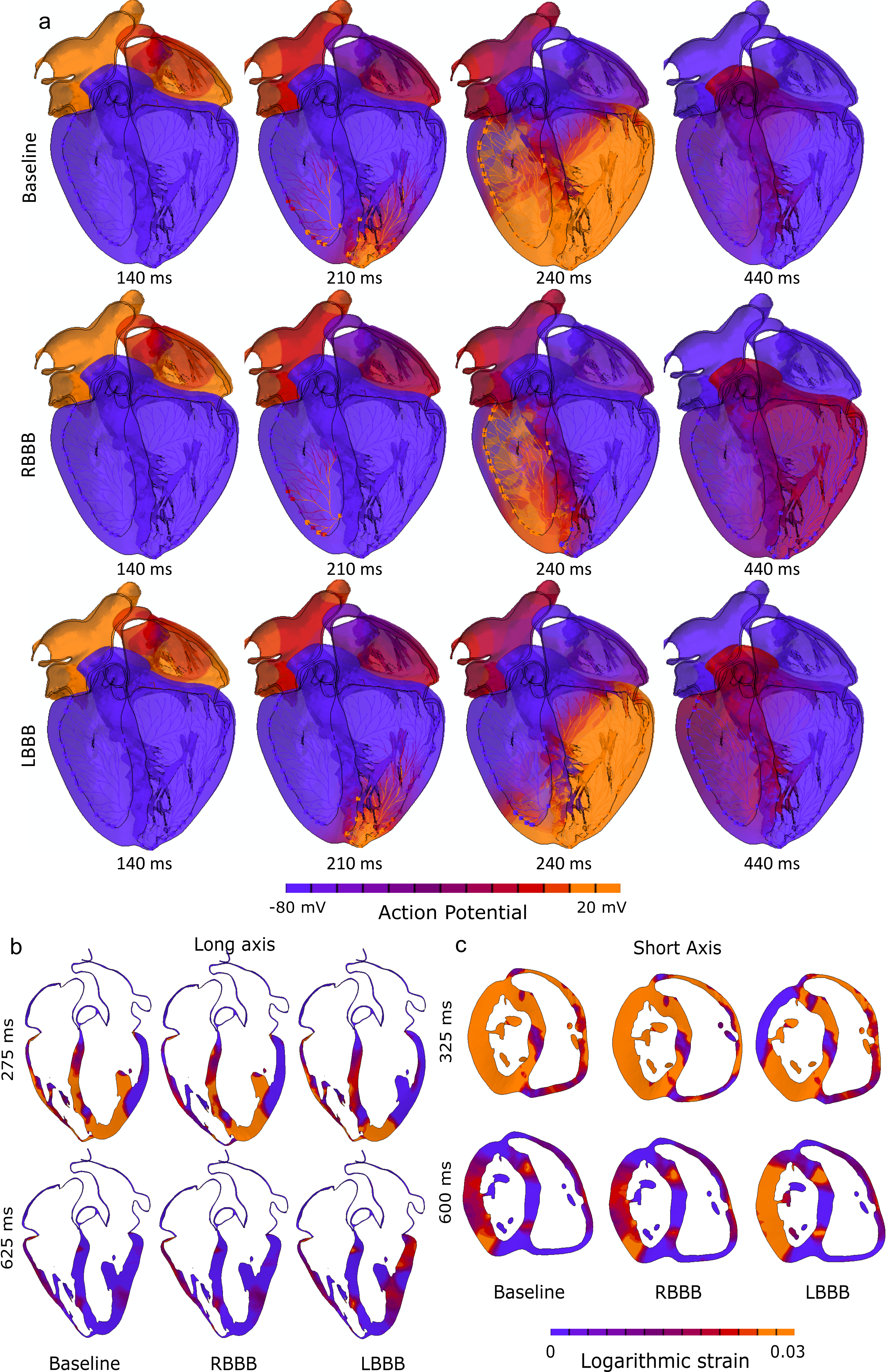 Preexisting conduction abnormalities modeling